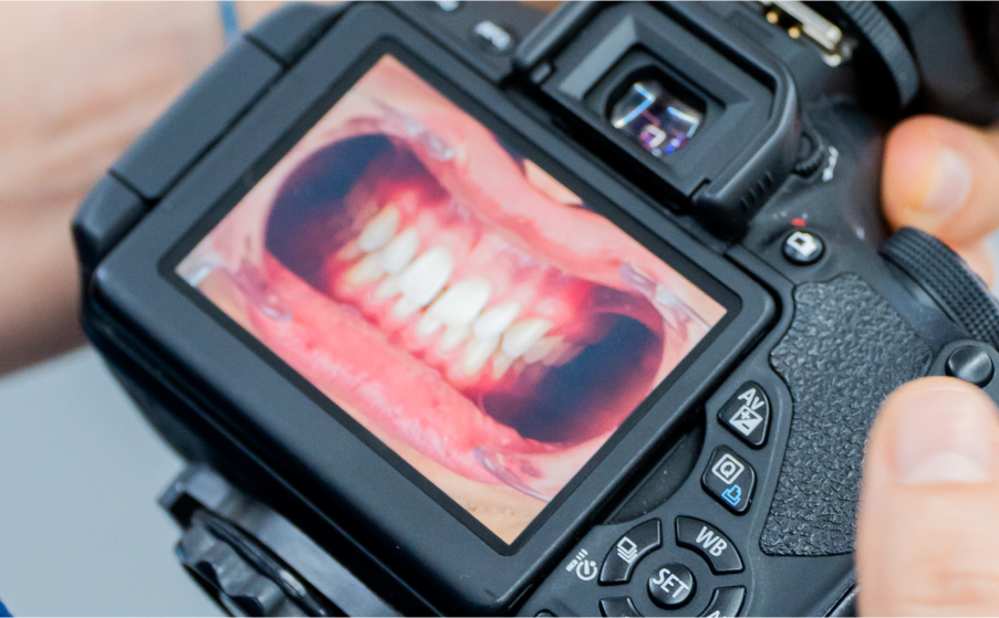 imagen rehabilitacion oral